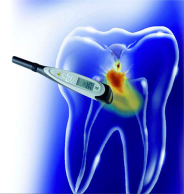 Preventing Cavities Faster