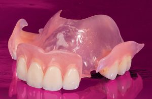 Flexible Partial denture